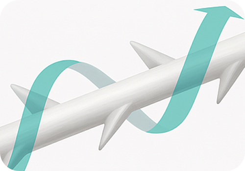 전방위적으로 고정