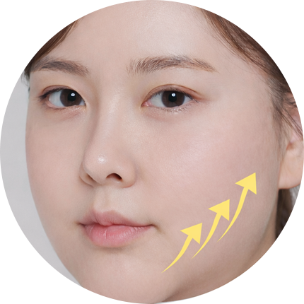 브이라인 리프팅 전