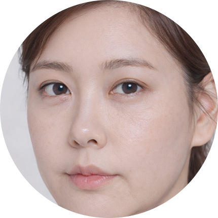 얼굴 전체 리프팅 전